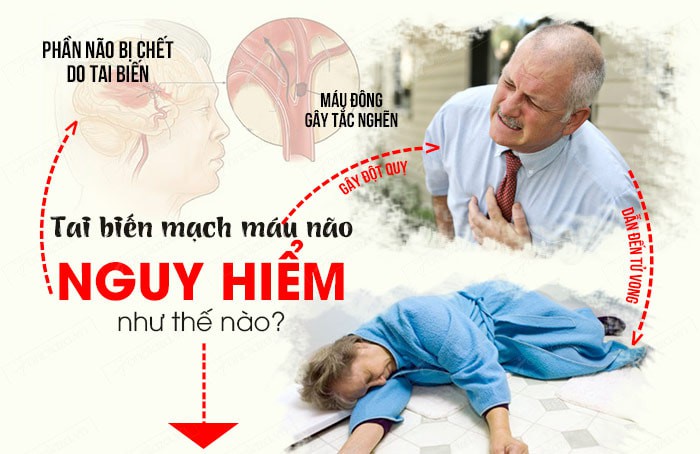 Suýt mất chồng chỉ vì không biết sơ cấp cứu ban đầu khi bị đột quỵ, người vợ trẻ ngậm ngùi đúc rút kinh nghiệm - Ảnh 6. Suýt mất chồng chỉ vì không biết sơ cấp cứu ban đầu khi bị đột quỵ, người vợ trẻ ngậm ngùi đúc rút kinh nghiệm - Ảnh 6.
