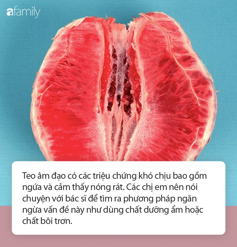 Thay đổi trong vùng kín khó thể tránh khỏi khi chị em phụ nữ bước sang độ tuổi mãn kinh - Ảnh 2. Thay đổi trong vùng kín khó thể tránh khỏi khi chị em phụ nữ bước sang độ tuổi mãn kinh - Ảnh 2.