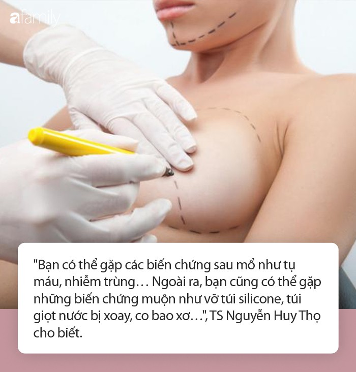 Ngày càng nhiều người tử vong do phẫu thuật nâng ngực: Đây là nguyên tắc sống còn trước khi bạn quyết định làm! - Ảnh 4. Ngày càng nhiều người tử vong do phẫu thuật nâng ngực: Đây là nguyên tắc sống còn trước khi bạn quyết định làm! - Ảnh 4.