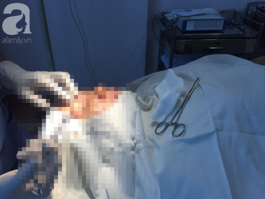 TP.HCM: Một phụ nữ nhập viện cấp cứu sau khi hút mỡ bụng tại cơ sở thẩm mỹ tư nhân - Ảnh 1. TP.HCM: Một phụ nữ nhập viện cấp cứu sau khi hút mỡ bụng tại cơ sở thẩm mỹ tư nhân - Ảnh 1.
