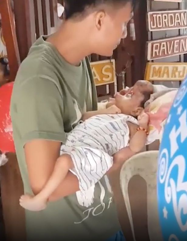 Thương cảm trước những em bé chào đời không được vẹn nguyên, em không có khuôn mặt hoặc khuôn mặt ị biến dạng - Ảnh 11. Thương cảm trước những em bé chào đời không được vẹn nguyên, em không có khuôn mặt hoặc khuôn mặt ị biến dạng - Ảnh 11.