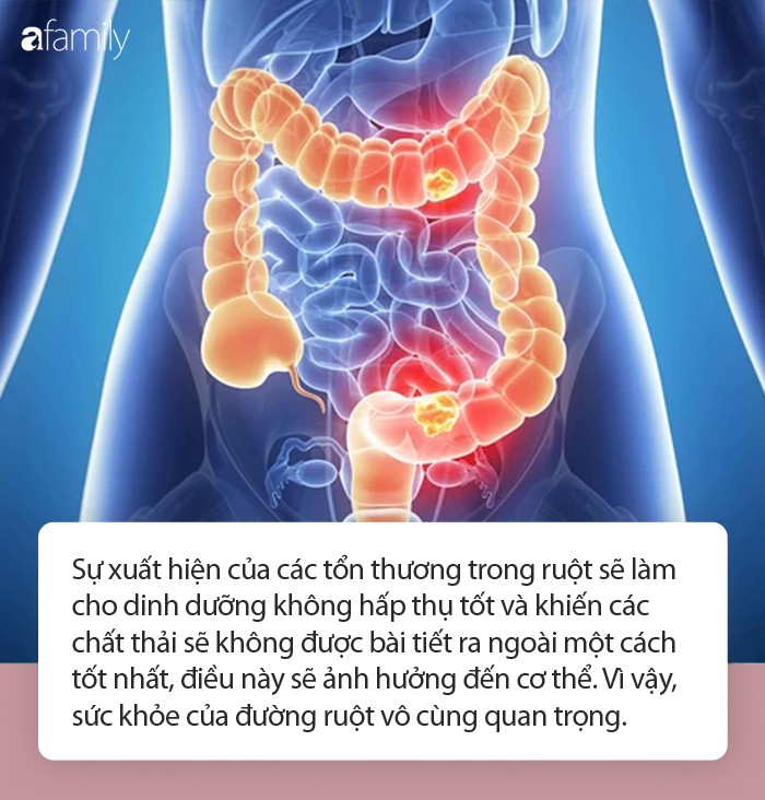 Cơ thể có 4 dấu hiệu này chứng tỏ đường ruột của bạn rất sạch - Ảnh 1. Cơ thể có 4 dấu hiệu này chứng tỏ đường ruột của bạn rất sạch - Ảnh 1.