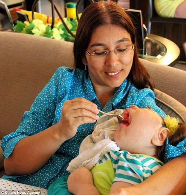 Thương cảm trước những em bé chào đời không được vẹn nguyên, em không có khuôn mặt hoặc khuôn mặt ị biến dạng - Ảnh 6. Thương cảm trước những em bé chào đời không được vẹn nguyên, em không có khuôn mặt hoặc khuôn mặt ị biến dạng - Ảnh 6.