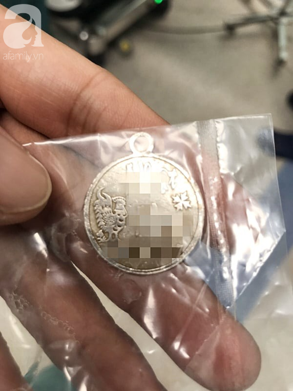 TP.HCM: Ngậm mặt dây chuyền rồi nuốt chửng vào họng, bé trai 2 tuổi bị tắt nghẽn đường thở nguy kịch tại nhà trẻ - Ảnh 2. TP.HCM: Ngậm mặt dây chuyền rồi nuốt chửng vào họng, bé trai 2 tuổi bị tắt nghẽn đường thở nguy kịch tại nhà trẻ - Ảnh 2.