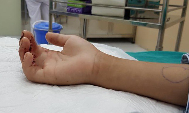 Những vụ con cái bị kẹt tay trong thang máy khiến cha mẹ kêu cứu trong tuyệt vọng - Ảnh 4. Những vụ con cái bị kẹt tay trong thang máy khiến cha mẹ kêu cứu trong tuyệt vọng - Ảnh 4.