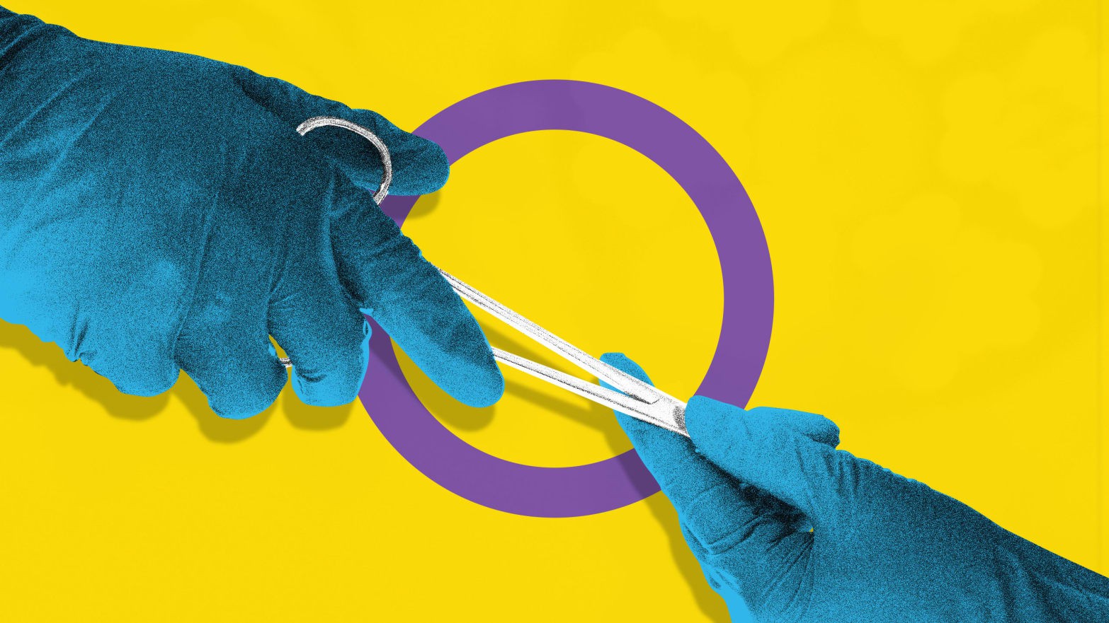 Liên giới tính: Có nên phẫu thuật ngay từ khi còn nhỏ hay không? - Ảnh 3. Liên giới tính: Có nên phẫu thuật ngay từ khi còn nhỏ hay không? - Ảnh 3.