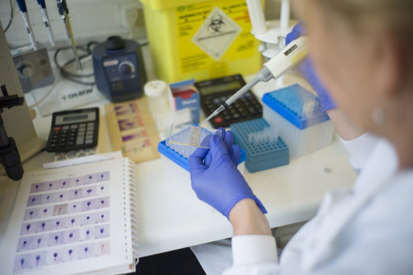 Thụ tinh của người cao 1m8 nhưng sinh con mắc bệnh lùn, bà mẹ ôm cay đắng đâm đơn kiện ngân hàng tinh trùng - Ảnh 1. Thụ tinh của người cao 1m8 nhưng sinh con mắc bệnh lùn, bà mẹ ôm cay đắng đâm đơn kiện ngân hàng tinh trùng - Ảnh 1.