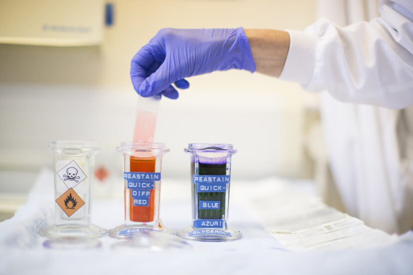 Thụ tinh của người cao 1m8 nhưng sinh con mắc bệnh lùn, bà mẹ ôm cay đắng đâm đơn kiện ngân hàng tinh trùng - Ảnh 3. Thụ tinh của người cao 1m8 nhưng sinh con mắc bệnh lùn, bà mẹ ôm cay đắng đâm đơn kiện ngân hàng tinh trùng - Ảnh 3.