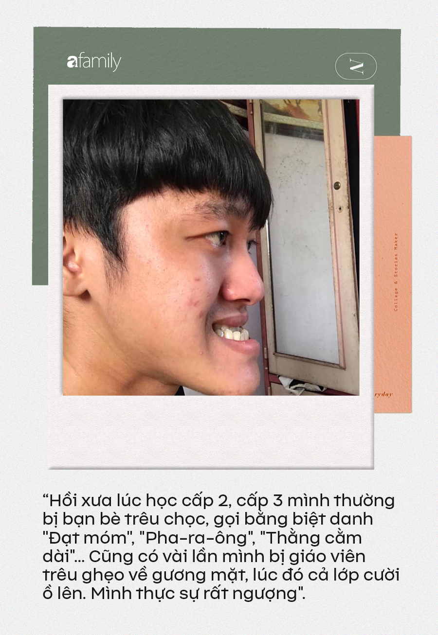 Bị gọi là “Pharaông” nhiều năm trời, chàng shipper 9x lột xác đúng chuẩn “soái ca” nhờ một phẫu thuật nhỏ có giá 70 triệu - Ảnh 2. Bị gọi là “Pharaông” nhiều năm trời, chàng shipper 9x lột xác đúng chuẩn “soái ca” nhờ một phẫu thuật nhỏ có giá 70 triệu - Ảnh 2.