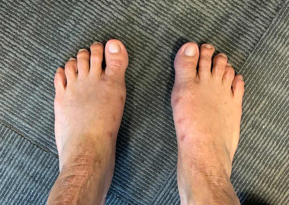 Có thể bạn chưa biết: Đi dép lê thực sự có tác dụng tuyệt vời, nhất là khi bạn gặp vấn đề này với bàn chân - Ảnh 2. Có thể bạn chưa biết: Đi dép lê thực sự có tác dụng tuyệt vời, nhất là khi bạn gặp vấn đề này với bàn chân - Ảnh 2.