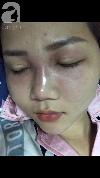 Mẹ một con kể chuyện phẫu thuật thẩm mỹ đau hơn… đau đẻ, lột xác sau 9 lần “dao kéo” với vỏn vẹn 30 triệu đồng - Ảnh 4. Mẹ một con kể chuyện phẫu thuật thẩm mỹ đau hơn… đau đẻ, lột xác sau 9 lần “dao kéo” với vỏn vẹn 30 triệu đồng - Ảnh 4.