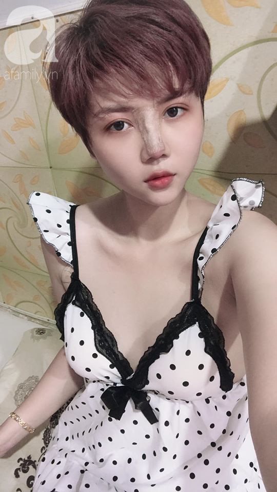 Mẹ một con kể chuyện phẫu thuật thẩm mỹ đau hơn… đau đẻ, lột xác sau 9 lần “dao kéo” với vỏn vẹn 30 triệu đồng - Ảnh 7. Mẹ một con kể chuyện phẫu thuật thẩm mỹ đau hơn… đau đẻ, lột xác sau 9 lần “dao kéo” với vỏn vẹn 30 triệu đồng - Ảnh 7.