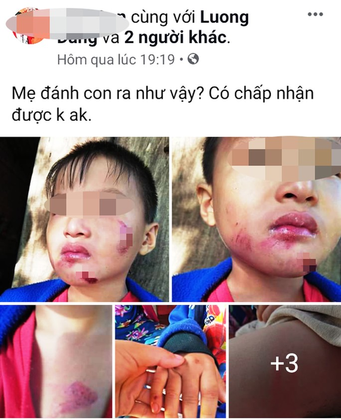 - Ảnh 2. - Ảnh 2.