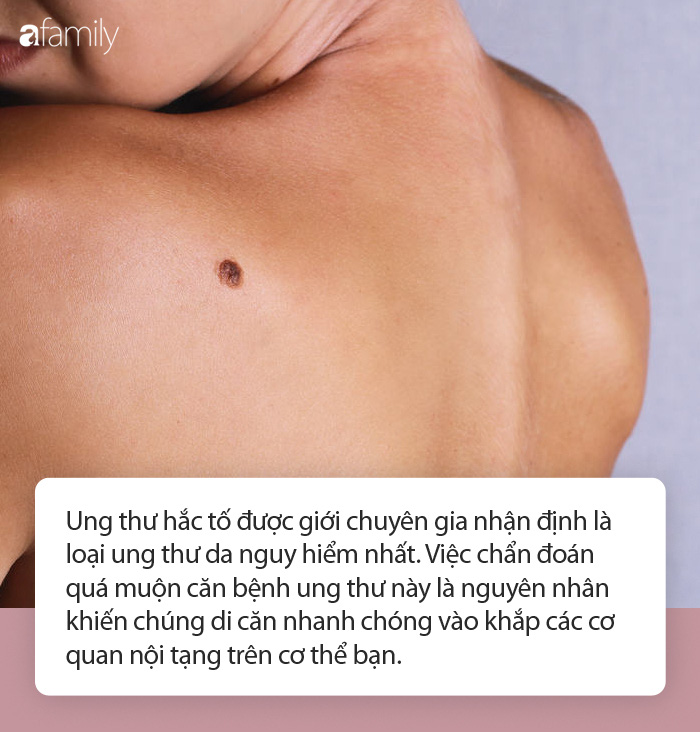 Đau nửa đầu kéo dài tưởng chỉ bị cúm, cô gái trẻ ngã ngửa khi biết mình đã bị ung thư "ăn" cả vào gan, phổi, xương... - Ảnh 6. Đau nửa đầu kéo dài tưởng chỉ bị cúm, cô gái trẻ ngã ngửa khi biết mình đã bị ung thư "ăn" cả vào gan, phổi, xương... - Ảnh 6.