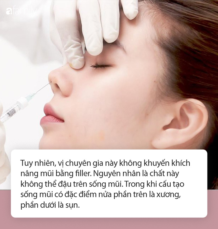 Mù mắt do làm đẹp bằng filler giá rẻ xuất hiện ngày càng nhiều: Khi nào chị em mới biết sợ? - Ảnh 3. Mù mắt do làm đẹp bằng filler giá rẻ xuất hiện ngày càng nhiều: Khi nào chị em mới biết sợ? - Ảnh 3.