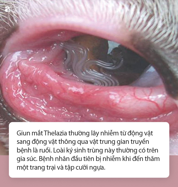 4 con giun mắt lăn lộn trong mắt người phụ nữ chỉ sau một lần chạy qua… một đàn ruồi - Ảnh 3. 4 con giun mắt lăn lộn trong mắt người phụ nữ chỉ sau một lần chạy qua… một đàn ruồi - Ảnh 3.