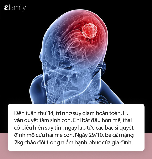 Hành trình mang thai gian nan, hôn mê, mất trí nhớ do khối u di căn não, hạnh phúc vỡ òa khi được làm mẹ - Ảnh 4.