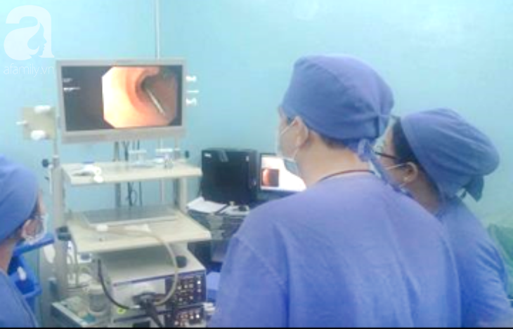 2 bé trai nuốt đinh nguy kịch trong cùng một ngày: Bác sĩ cảnh báo nguy cơ thủng ruột, tử vong - Ảnh 2. 2 bé trai nuốt đinh nguy kịch trong cùng một ngày: Bác sĩ cảnh báo nguy cơ thủng ruột, tử vong - Ảnh 2.