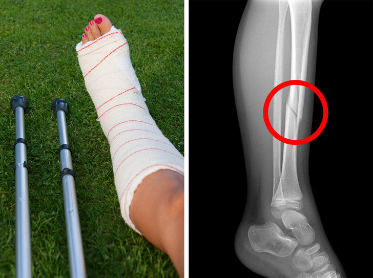 Chị em thích uống sữa đến cỡ nào cũng phải dừng lại ngay nếu có 9 dấu hiệu này, bằng không sẽ tổn hại đến sức khỏe - Ảnh 5. Chị em thích uống sữa đến cỡ nào cũng phải dừng lại ngay nếu có 9 dấu hiệu này, bằng không sẽ tổn hại đến sức khỏe - Ảnh 5.