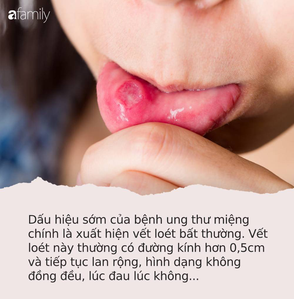 Những dấu hiệu ung thư nhưng dễ bị nhầm là 