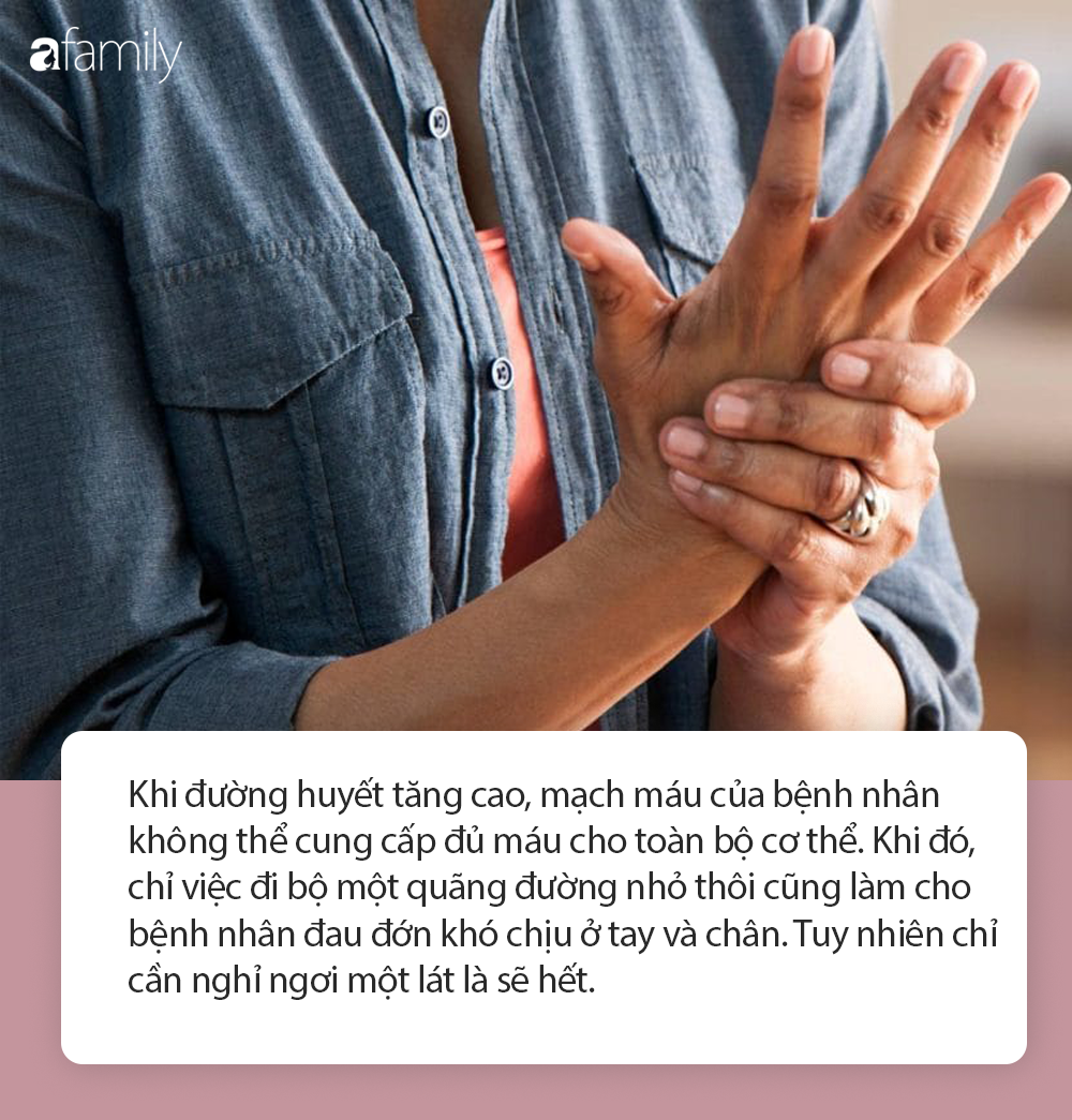 Nếu tay chân xuất hiện những dấu hiệu này thì lượng đường trong máu đang tăng cao, chị em cần phải bỏ ăn đồ ngọt ngay - Ảnh 3. Nếu tay chân xuất hiện những dấu hiệu này thì lượng đường trong máu đang tăng cao, chị em cần phải bỏ ăn đồ ngọt ngay - Ảnh 3.