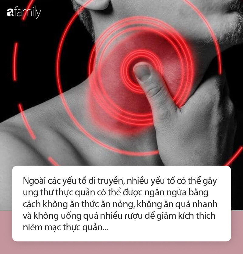 Người đàn ông bị ung thư thực quản do ăn lẩu quá nhiều, cảnh báo loại bỏ thói quen khi ăn lẩu tránh gây ung thư - Ảnh 3. Người đàn ông bị ung thư thực quản do ăn lẩu quá nhiều, cảnh báo loại bỏ thói quen khi ăn lẩu tránh gây ung thư - Ảnh 3.