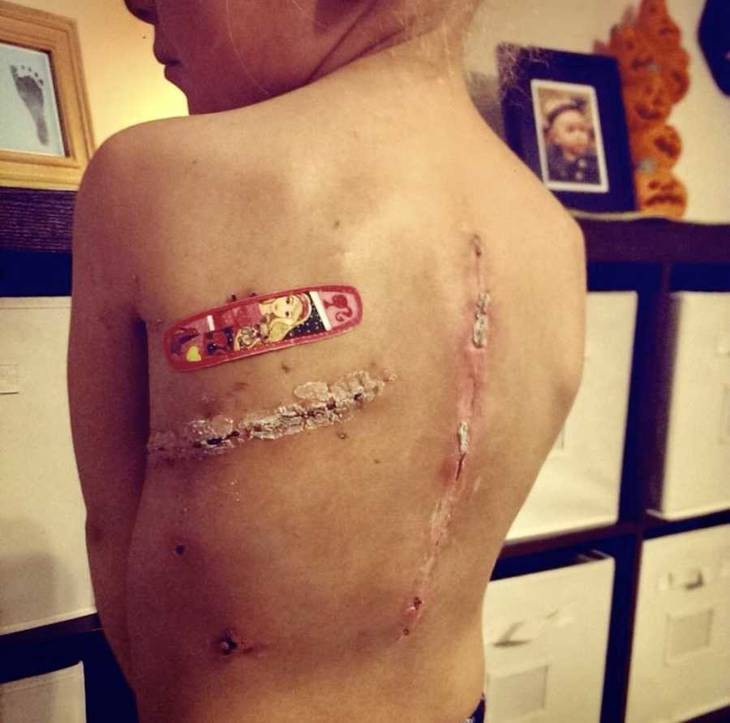 Con gái khóc lóc đòi che đi vết sẹo do ung thư, người mẹ chỉ nói một câu khiến ai nấy cũng đều cảm động - Ảnh 4. Con gái khóc lóc đòi che đi vết sẹo do ung thư, người mẹ chỉ nói một câu khiến ai nấy cũng đều cảm động - Ảnh 4.