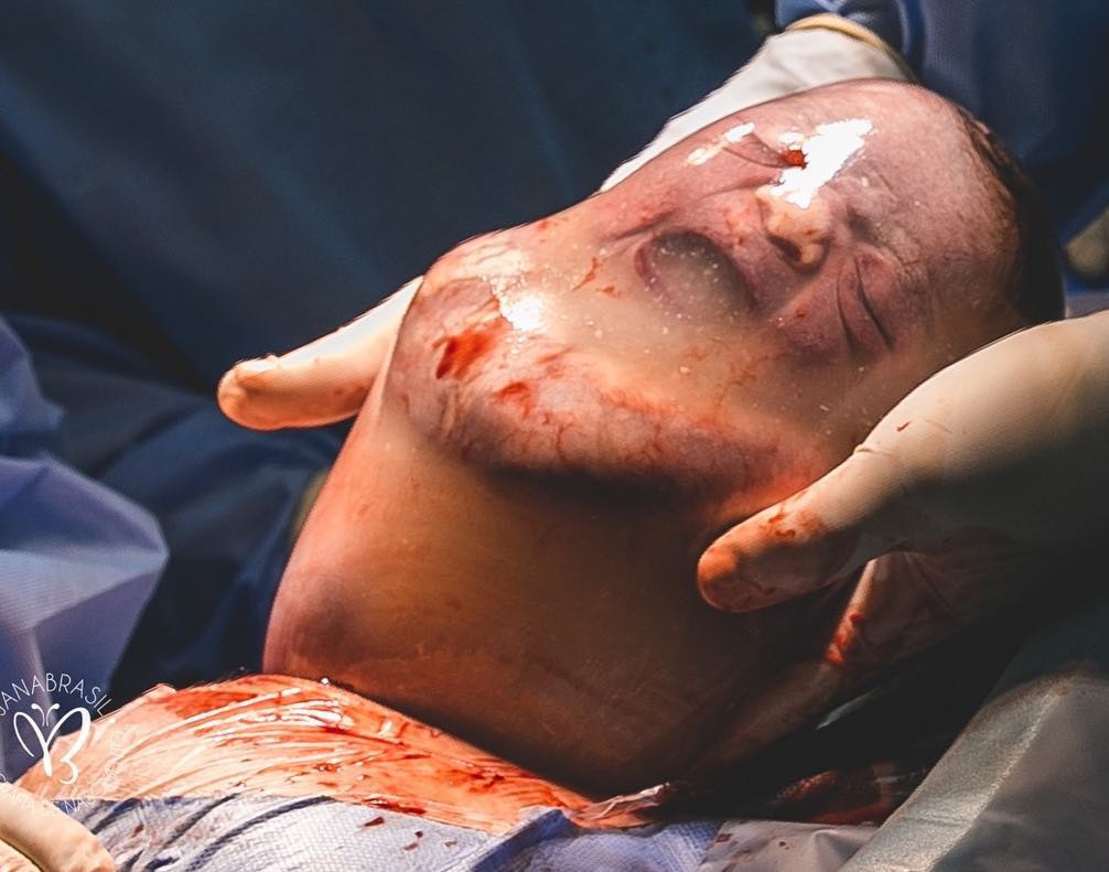 Em bé “nổi như cồn” vì vừa nằm trong túi ối vừa làm trò, hết chu mỏ đến thè lưỡi trêu chọc mọi người - Ảnh 3. Em bé “nổi như cồn” vì vừa nằm trong túi ối vừa làm trò, hết chu mỏ đến thè lưỡi trêu chọc mọi người - Ảnh 3.