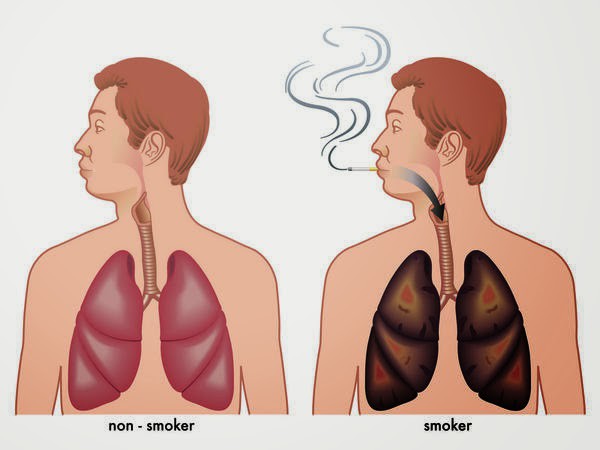 Một số phương pháp tự nhiên mà ai cũng có thể thực hiện để làm sạch phổi của mình - Ảnh 1.