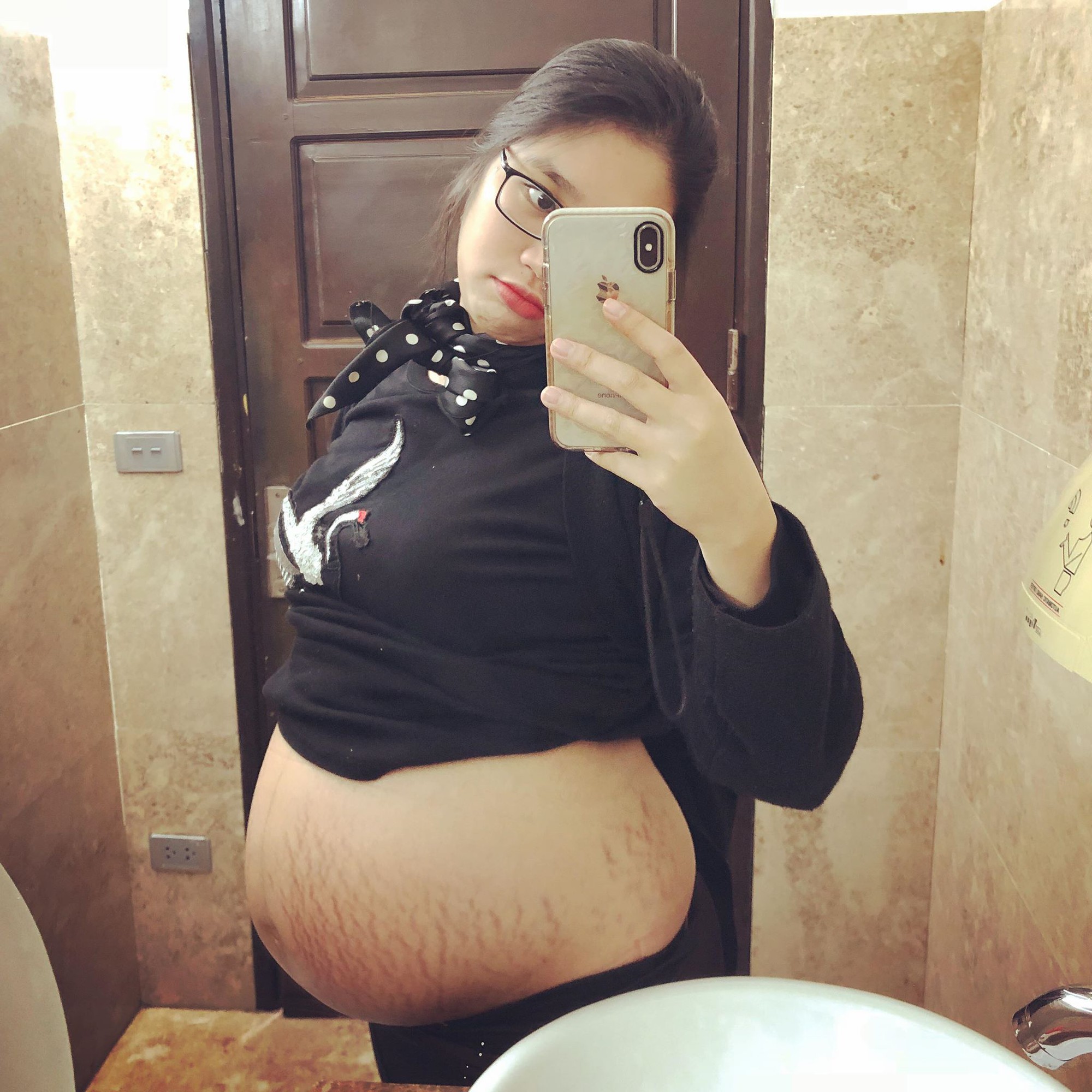 Mẹ trẻ kể hành trình sinh con gian nan, chịu đủ cả cảm giác đau đẻ, đau mổ, áp xe ngực khiến chị em đồng cảm - Ảnh 4. Mẹ trẻ kể hành trình sinh con gian nan, chịu đủ cả cảm giác đau đẻ, đau mổ, áp xe ngực khiến chị em đồng cảm - Ảnh 4.