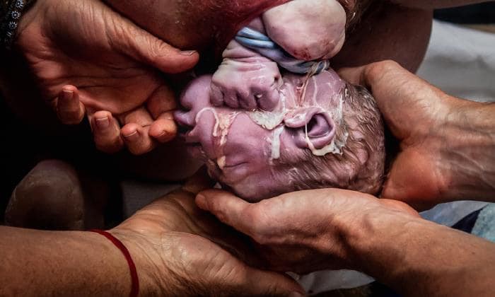 Nghẹt thở, xúc động và vỡ òa cảm xúc với loạt hình ảnh tái hiện vẻ đẹp khi sinh nở trong suốt đầu năm 2019 - Ảnh 9. Nghẹt thở, xúc động và vỡ òa cảm xúc với loạt hình ảnh tái hiện vẻ đẹp khi sinh nở trong suốt đầu năm 2019 - Ảnh 9.