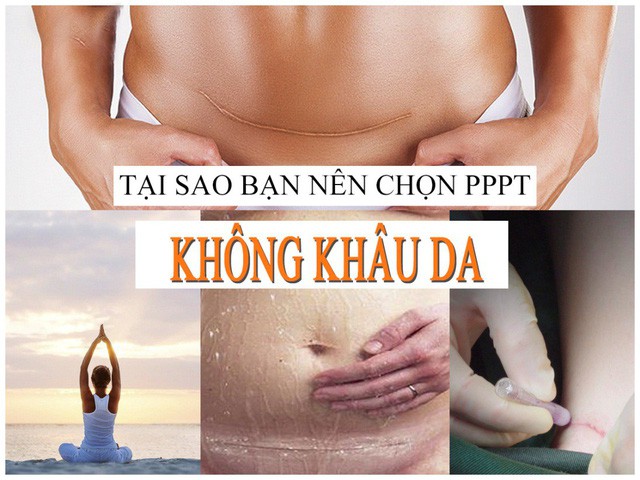 Phẫu thuật không khâu da – Giải pháp trọn vẹn cho lĩnh vực Phẫu thuật thẩm mỹ - Ảnh 1. Phẫu thuật không khâu da – Giải pháp trọn vẹn cho lĩnh vực Phẫu thuật thẩm mỹ - Ảnh 1.