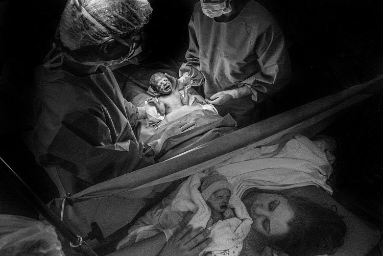 Chùm ảnh xúc động về những ca sinh mổ cho ta thấy các bà mẹ mới là những chiến binh thực thụ trên đời - Ảnh 8. Chùm ảnh xúc động về những ca sinh mổ cho ta thấy các bà mẹ mới là những chiến binh thực thụ trên đời - Ảnh 8.