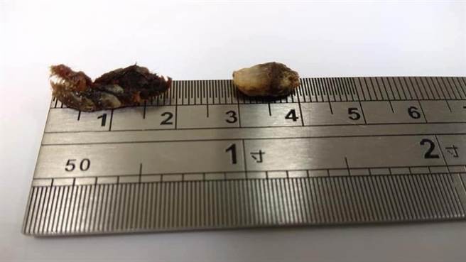 Bác sĩ hé lộ nguyên's nhân's khiến bé 3 tuổi bỗng nhiên bất thính lực - Ảnh 1. Bác sĩ hé lộ nguyên's nhân's khiến bé 3 tuổi bỗng nhiên bất thính lực - Ảnh 1.