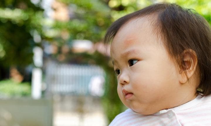 Đây chính là điều cha mẹ nên lo lắng khi con cái thường xuyên bị muỗi đốt - Ảnh 2. Đây chính là điều cha mẹ nên lo lắng khi con cái thường xuyên bị muỗi đốt - Ảnh 2.