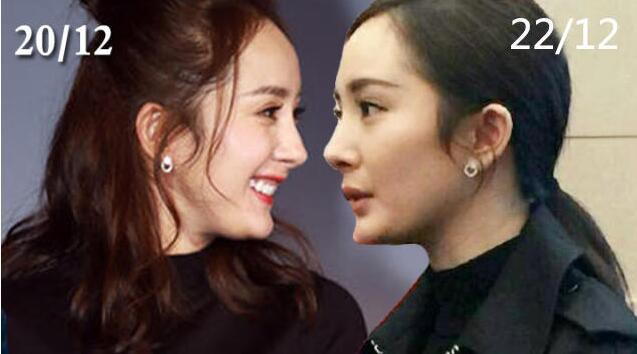 Loạt h&igrave;nh g&oacute;c nghi&ecirc;ng g&acirc;y b&atilde;o của d&agrave;n sao ch&acirc;u &Aacute;: Người đẹp như ti&ecirc;n nữ, kẻ lộ dấu vết dao k&eacute;o - Ảnh 17.