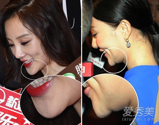 Loạt h&igrave;nh g&oacute;c nghi&ecirc;ng g&acirc;y b&atilde;o của d&agrave;n sao ch&acirc;u &Aacute;: Người đẹp như ti&ecirc;n nữ, kẻ lộ dấu vết dao k&eacute;o - Ảnh 19.