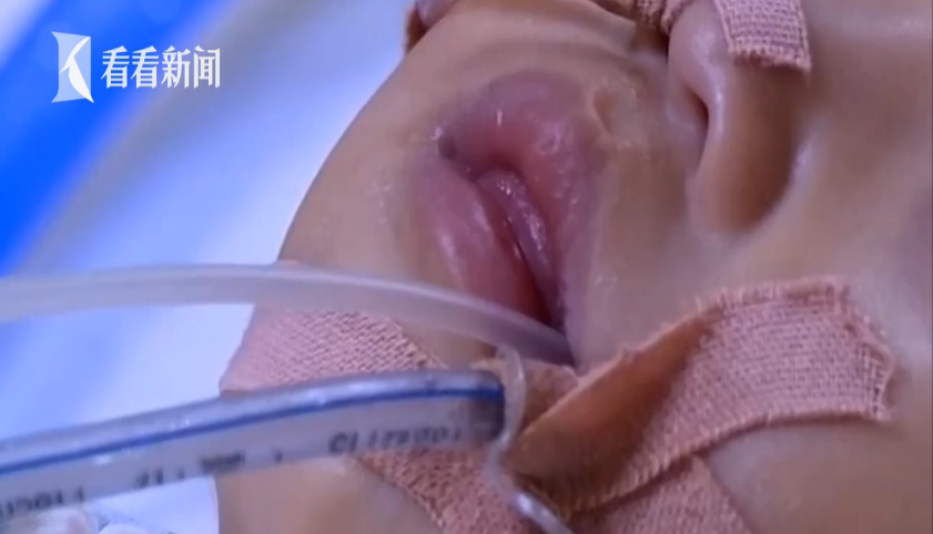 Con trai 15 tháng tuổi tim ngừng đập hơn 40 phút và hôn mê sâu chỉ vì phản ứng chậm trễ này của người mẹ - Ảnh 3. Con trai 15 tháng tuổi tim ngừng đập hơn 40 phút và hôn mê sâu chỉ vì phản ứng chậm trễ này của người mẹ - Ảnh 3.