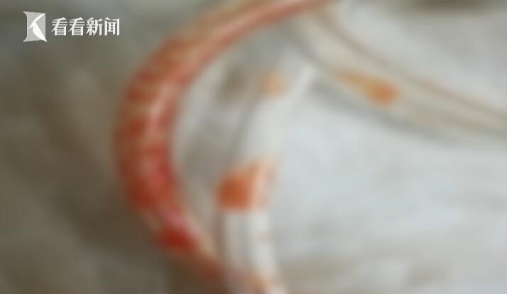 Con trai 15 tháng tuổi tim ngừng đập hơn 40 phút và hôn mê sâu chỉ vì phản ứng chậm trễ này của người mẹ - Ảnh 2. Con trai 15 tháng tuổi tim ngừng đập hơn 40 phút và hôn mê sâu chỉ vì phản ứng chậm trễ này của người mẹ - Ảnh 2.