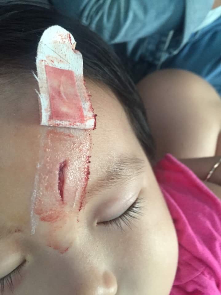 Trung tâm kiểm soát và phòng ngừa dịch bệnh Mỹ lên tiếng: Một cậu bé 6 tuổi suýt chết vì uốn ván do bố mẹ anti-vaccine - Ảnh 2. Trung tâm kiểm soát và phòng ngừa dịch bệnh Mỹ lên tiếng: Một cậu bé 6 tuổi suýt chết vì uốn ván do bố mẹ anti-vaccine - Ảnh 2.