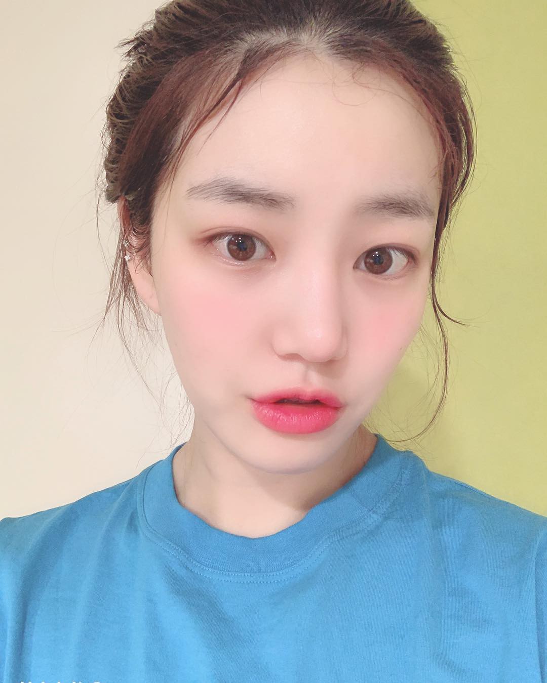 Mùa mụn hoành hành đã đến nhưng da bạn vẫn sẽ mịn đẹp bền bỉ nếu bật sẵn chế độ phòng vệ - Ảnh 1. Mùa mụn hoành hành đã đến nhưng da bạn vẫn sẽ mịn đẹp bền bỉ nếu bật sẵn chế độ phòng vệ - Ảnh 1.