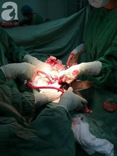 Cứu sống sản phụ mang song thai chết lưu: BS tư vấn chị em khi mang thai cần làm những việc này - Ảnh 1. Cứu sống sản phụ mang song thai chết lưu: BS tư vấn chị em khi mang thai cần làm những việc này - Ảnh 1.