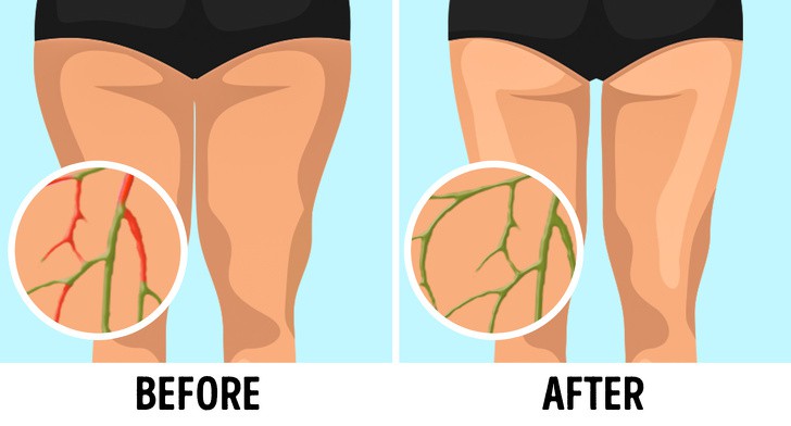 6 bài tập đơn giản có tác dụng lưu thông hệ bạch huyết, giúp giảm cân không cần ăn kiêng - Ảnh 1. 6 bài tập đơn giản có tác dụng lưu thông hệ bạch huyết, giúp giảm cân không cần ăn kiêng - Ảnh 1.