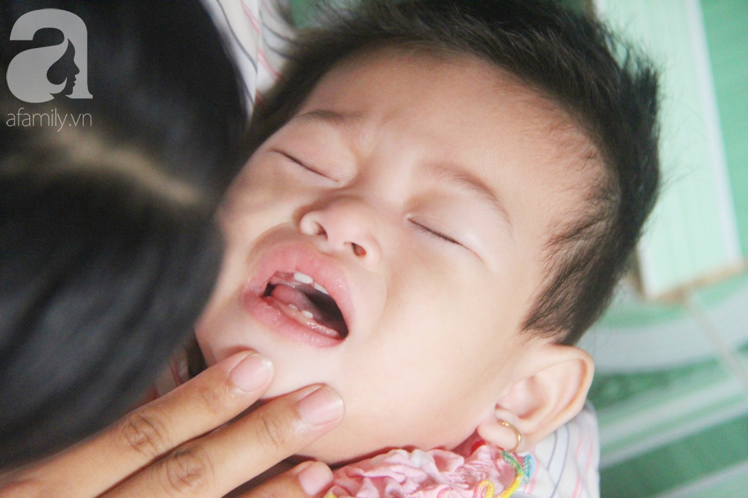 Bé gái 1 tuổi co giật liên tục đến mức méo miệng, người mẹ trẻ khóc cạn nước mắt cầu xin một cơ hội sống cho con - Ảnh 4.