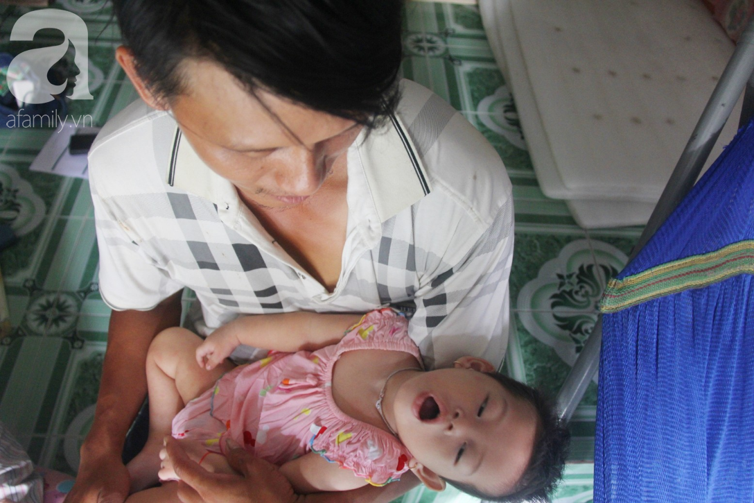 Bé gái 1 tuổi co giật liên tục đến mức méo miệng, người mẹ trẻ khóc cạn nước mắt cầu xin một cơ hội sống cho con - Ảnh 15.