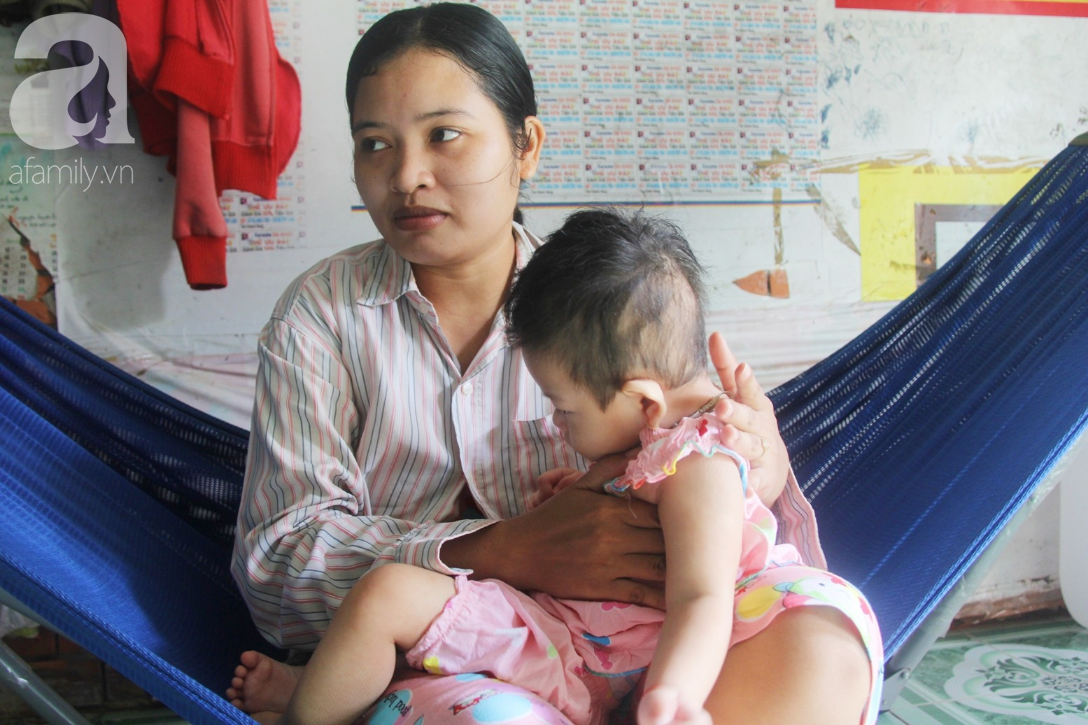 Bé gái 1 tuổi co giật liên tục đến mức méo miệng, người mẹ trẻ khóc cạn nước mắt cầu xin một cơ hội sống cho con - Ảnh 9.