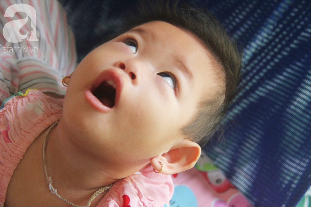 Bé gái 1 tuổi co giật liên tục đến mức méo miệng, người mẹ trẻ khóc cạn nước mắt cầu xin một cơ hội sống cho con - Ảnh 10.