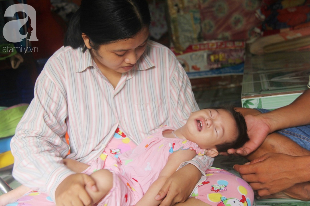 Bé gái 1 tuổi co giật liên tục đến mức méo miệng, bố mẹ nghèo bật khóc khi đã có tiền chữa bệnh cho con - Ảnh 3.