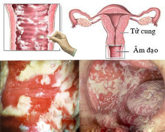 Bạn đ&atilde; thực sự hiểu hết về cốc nguyệt san: Lời giải từ chuy&ecirc;n gia đầu ng&agrave;nh về sản phẩm &ldquo;hot hit&rdquo; n&agrave;y - Ảnh 3.