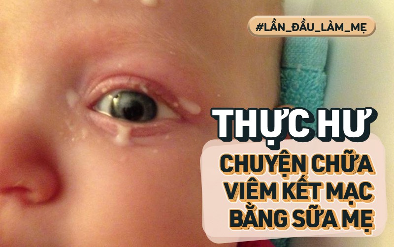 Có thật sữa mẹ chữa được viêm kết mạc và viêm tai giữa? - Bác sĩ nhi sẽ cho các mẹ câu trả lời chính xác nhất - Ảnh 1. Có thật sữa mẹ chữa được viêm kết mạc và viêm tai giữa? - Bác sĩ nhi sẽ cho các mẹ câu trả lời chính xác nhất - Ảnh 1.